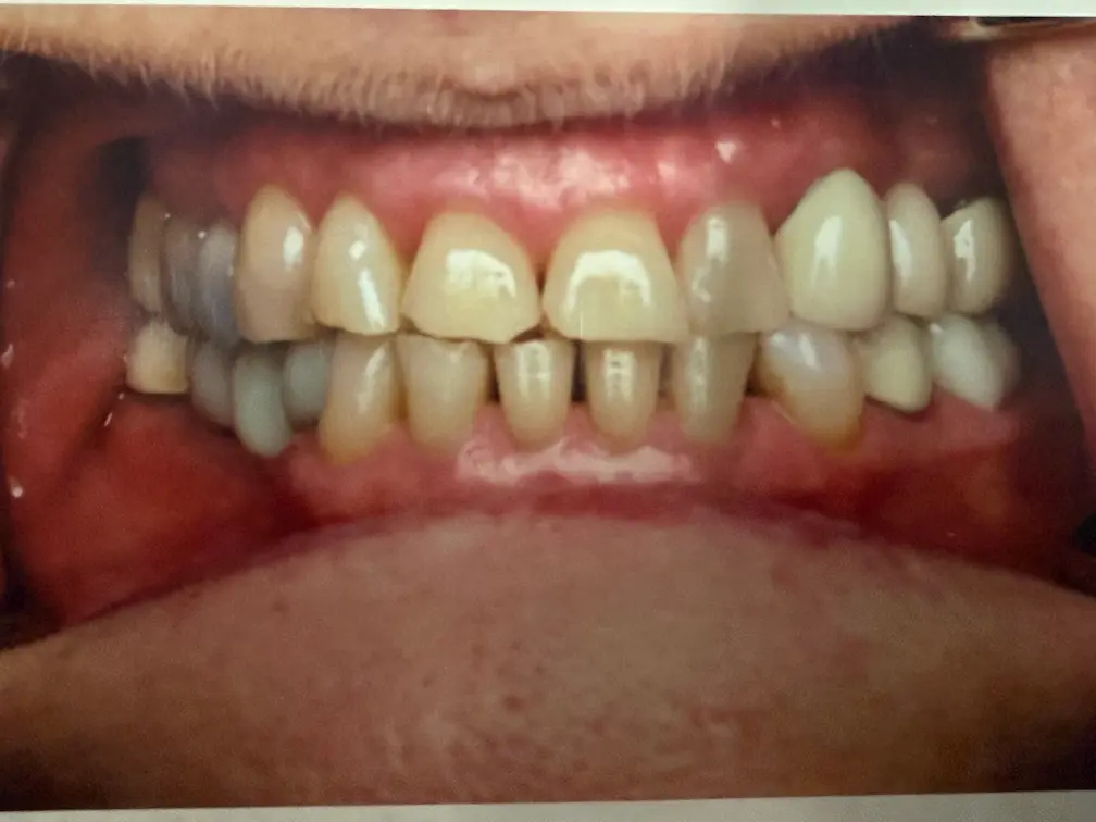 Before smile makeover